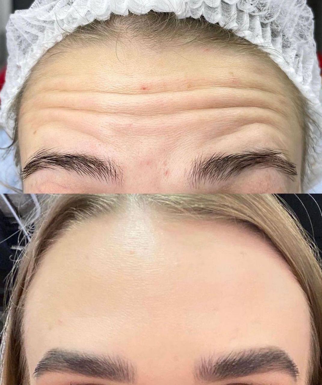 До лікування