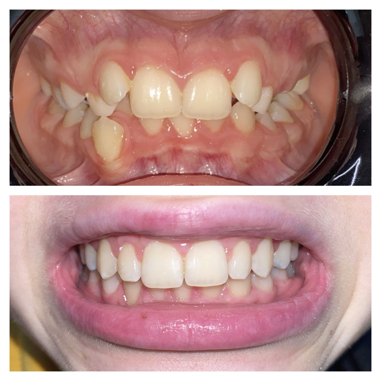 До лікування