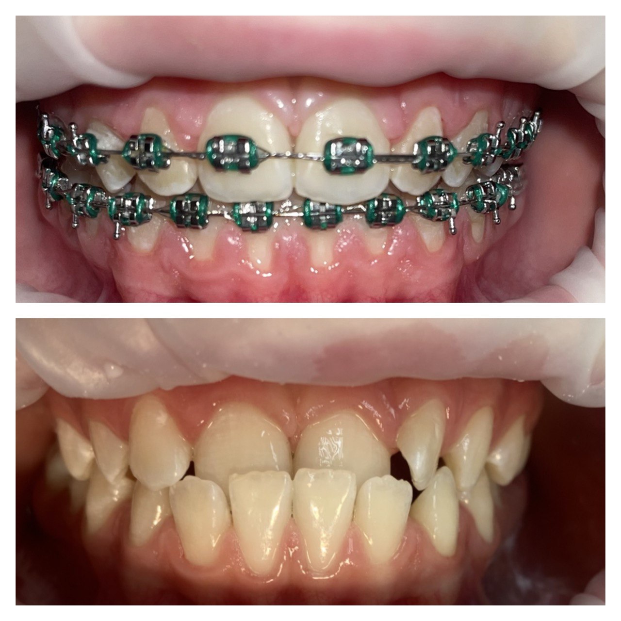 Після лікування