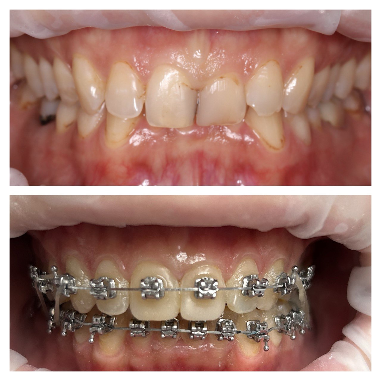 До лікування