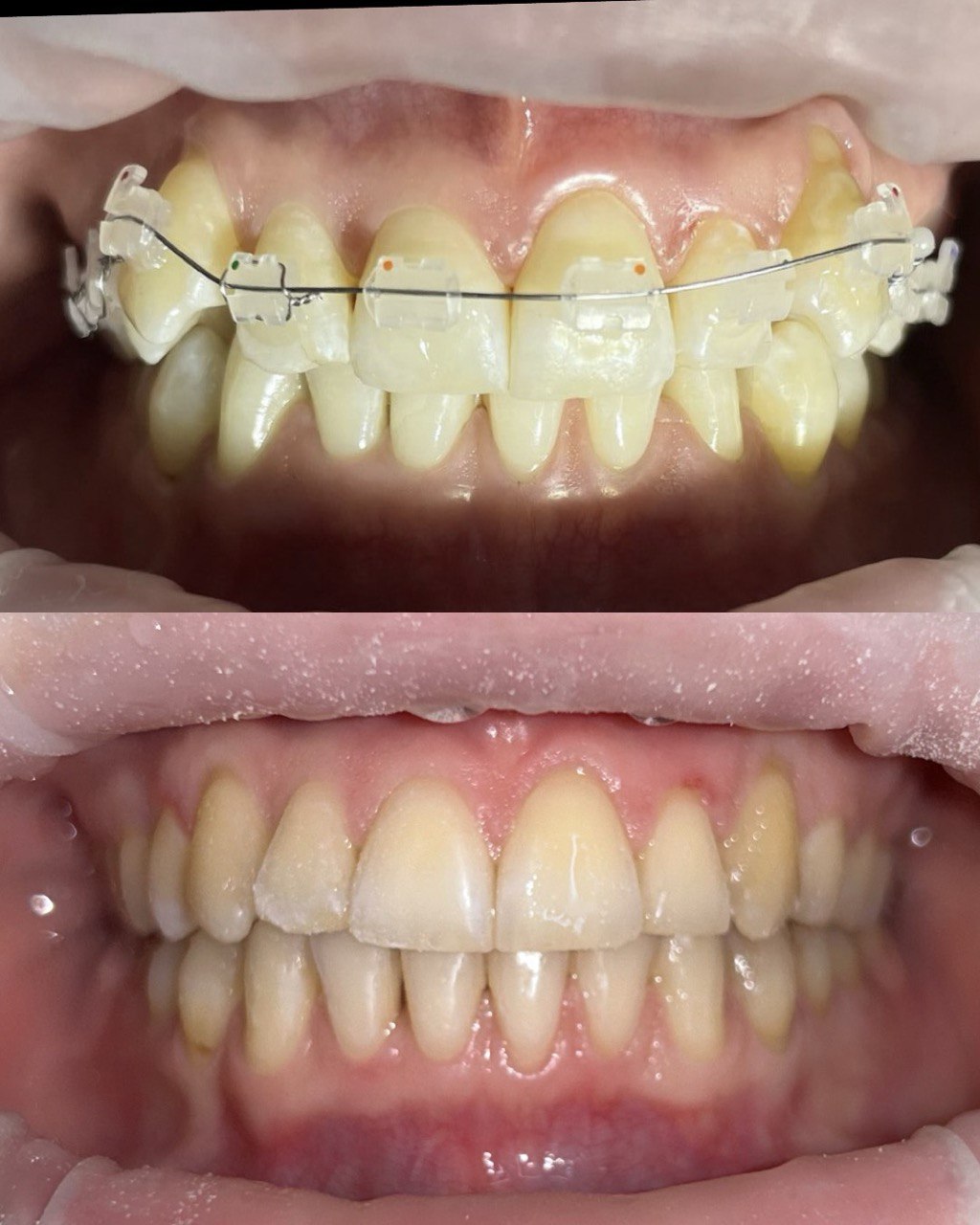 Після лікування